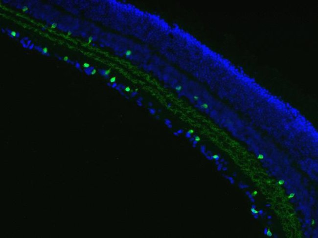 Image of rat retinal tissue that was fixed and stained for cholinergic amacrine cells was captured using the FLoid® Cell Imaging Station (Cat.no. 4471136).